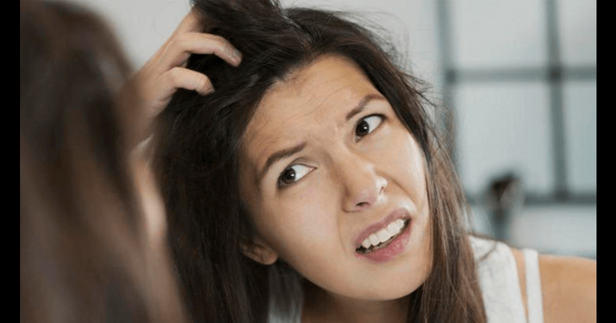 This is how you can end acne on your scalp