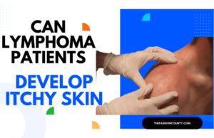 Can Lymphoma Patients Develop Itchy Skin
